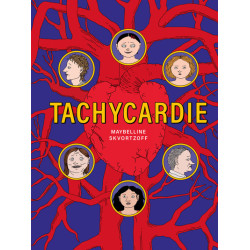 Tachycardie